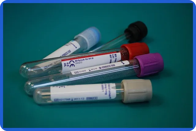 무담보사채 투자 안전성과 위험 모두 분석하기